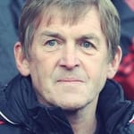 เคนนี่ ดัลกลิช (Kenny Dalglish)